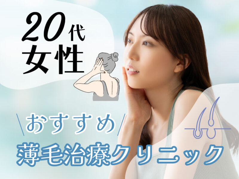 20代女性におすすめの薄毛治療クリニック
