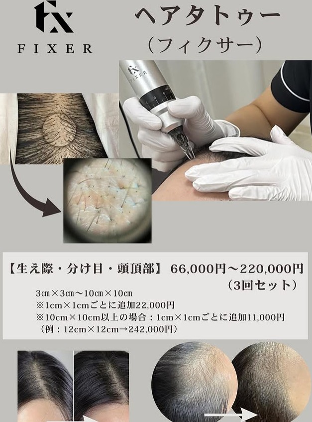 クレアージュ札幌頭皮アートメイク