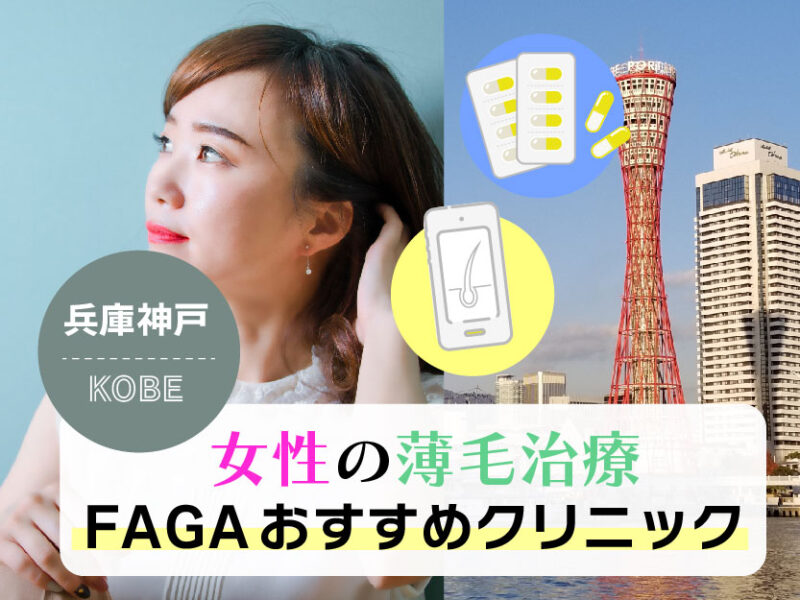 女性の薄毛治療FAGAおすすめクリニック_兵庫神戸