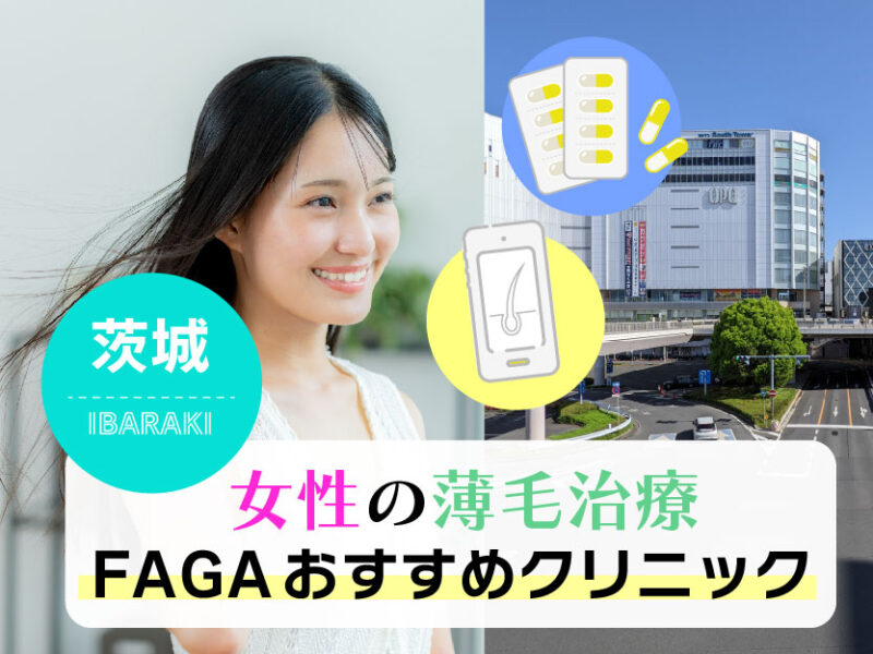 女性の薄毛治療FAGAおすすめクリニック_茨城